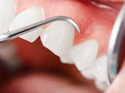 periodontia periodontia