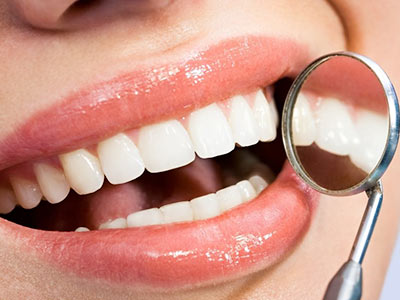 restauração de dentes restauração de dentes
