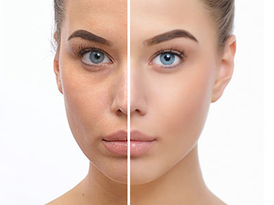 skinbooster skinbooster