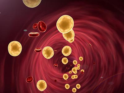 Tratamento para a Dislipidemia Dislipidemia