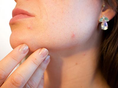 Tratamento para doenças de natureza hormonal e metabólica Doenças de natureza hormonal e metabólica