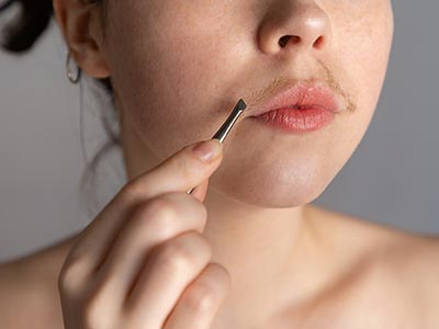 Tratamento para o Hirsutismo Hirsutismo