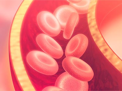 Saúde vascular Saúde vascular