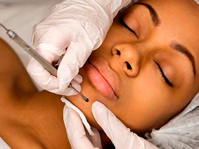 Estética procedimentos estéticos