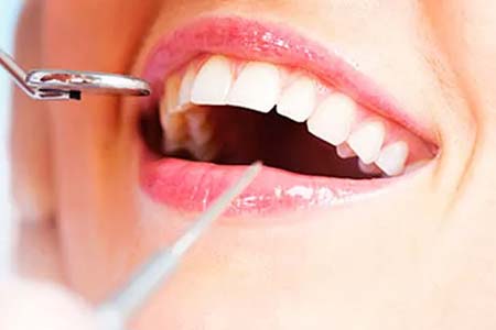 Profilaxia profilaxia dental