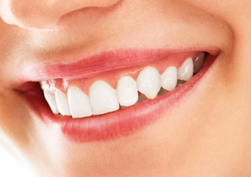 gengivoplastia gengivoplastia