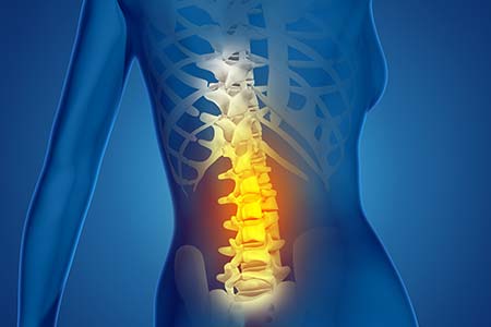 Reabilitação pós-cirurgia de coluna reabilitação pós-cirurgia de coluna