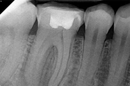 Radiografias odontológicas radiografias odontológicas