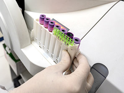 Exames laboratoriais