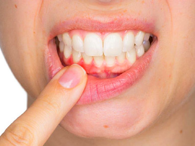 periodontia periodontia