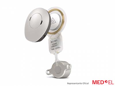 Sistema Bonebridge Med-El Sistema Bonebridge Med-El