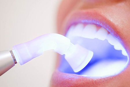 clareamento dental