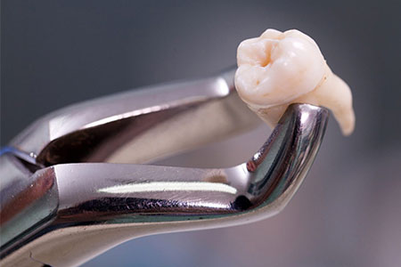 Cirurgias odontológicas cirurgias odontológicas