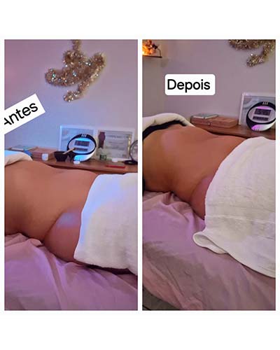massagem modeladora massagem modeladora