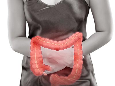 Síndrome do intestino irritado Síndrome do intestino irritado