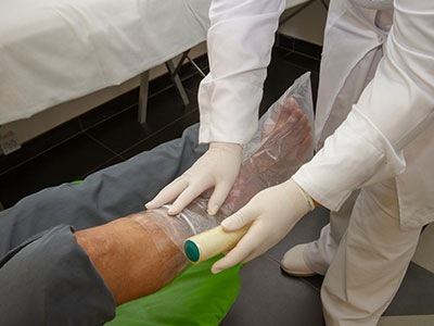 ozonioterapia