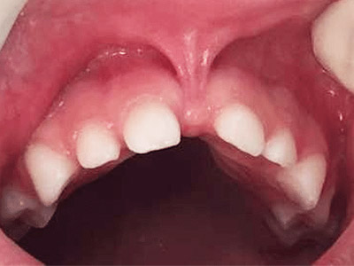 cirurgias dentárias cirurgias bucais