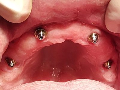 protocolo dentário protocolo dentário