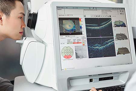 OCT – Tomografia de Coerência Óptica tomografia de coerência óptica