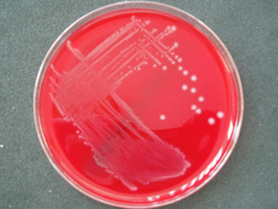 Cultura para Streptococcus Agalactiae Cultura para Streptococcus Agalactiae