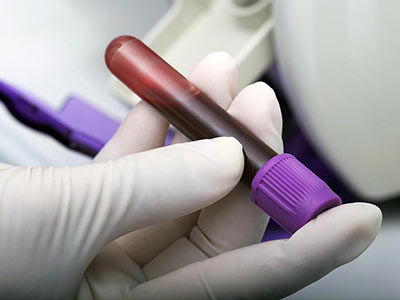 Exame de sangue Exame de sangue