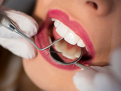 Soluções em Endodontia