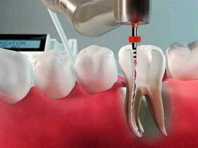 endodontia