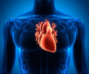 Cardiomiopatia Cardiomiopatia