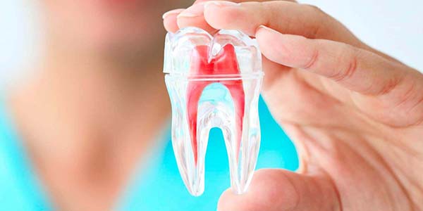 Endodontia Endodontia