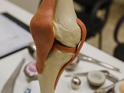 Ortopedia especializada em joelho e quadril Cirurgia do joelho
