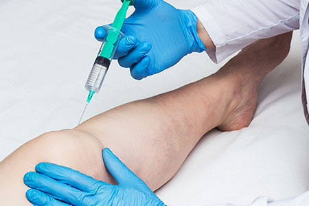Tratamento para alergias ozonioterapia
