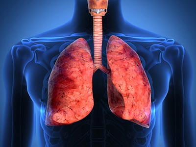 Fibrose pulmonar Fibrose pulmonar