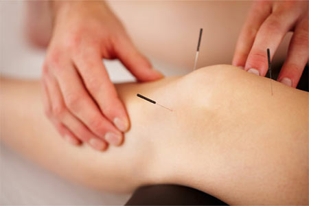 acupuntura para artrite e artrose