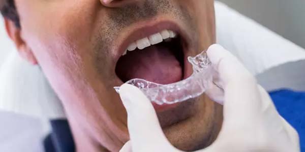 Endodontia e ortodontia em Presidente Prudente Aparelho ortodôntico e tratamento de canal