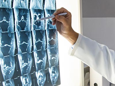 Radiografia do joelho