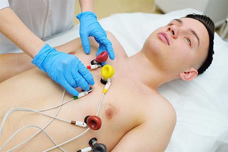 ECG ecg