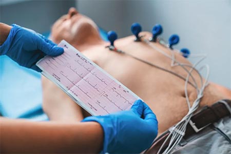 Eetrocardiograma eletrocardiograma