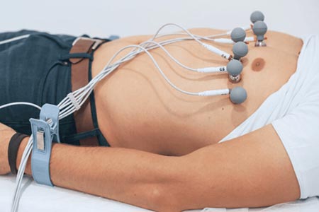 Eletrocardiograma exame de eletrocardiograma