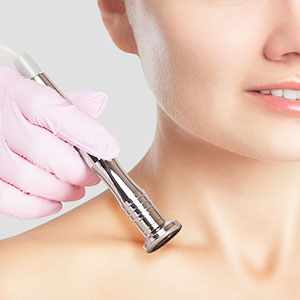 cirurgia de dermoabrasão