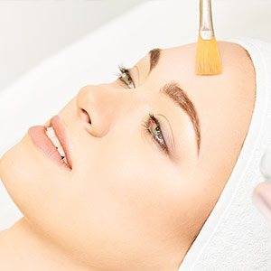 peeling químico