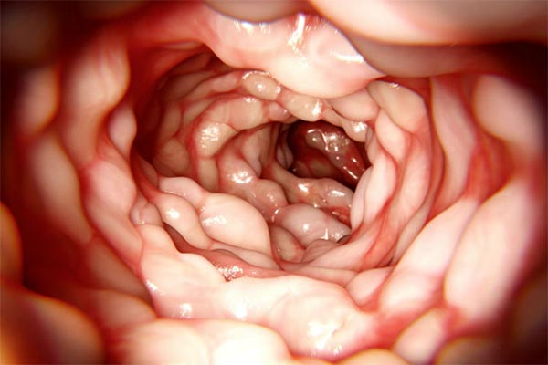 Imagem em 3D do interior do intestino grosso