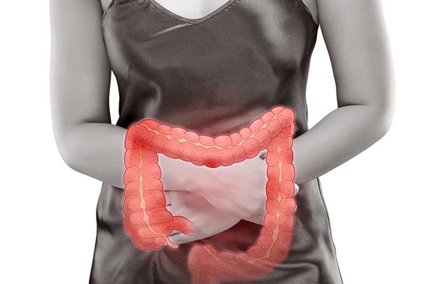 Ilustração do intestino grosso sobre o abdômen de uma paciente