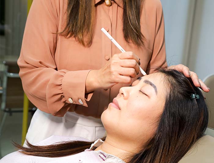 Tratamento para rugas e linhas de expressão Profissional marcando pontos na testa de paciente para procedimento facial